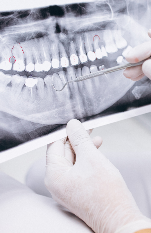 Clinicas Den - Cirugia Oral y Maxilofacial en Barcelona - Implantes Dentales