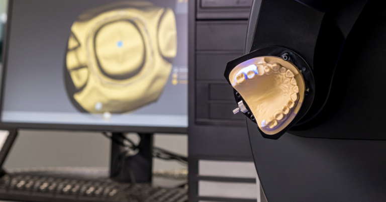 CAD/CAM ¿Qué es y cómo funciona en odontología?
