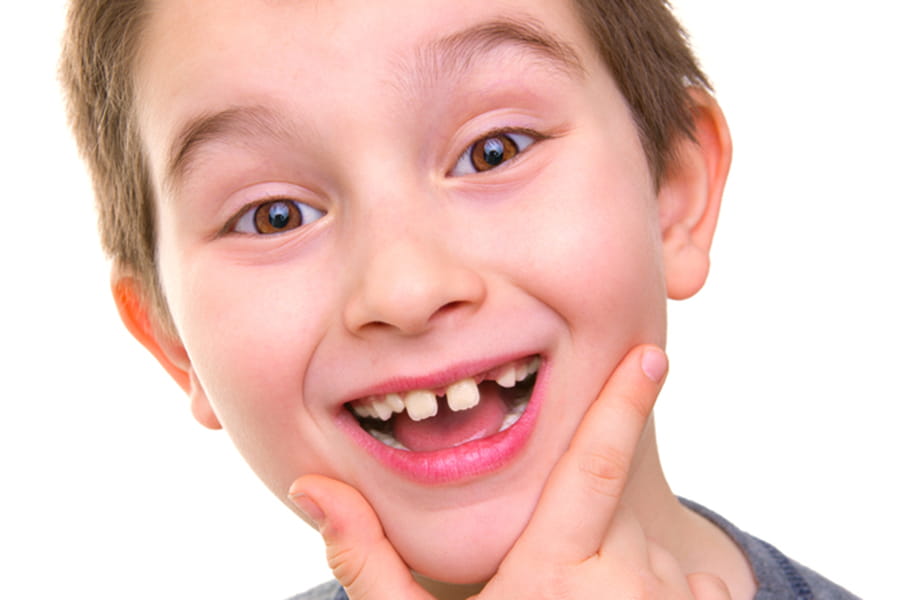 Diastema dental en niños