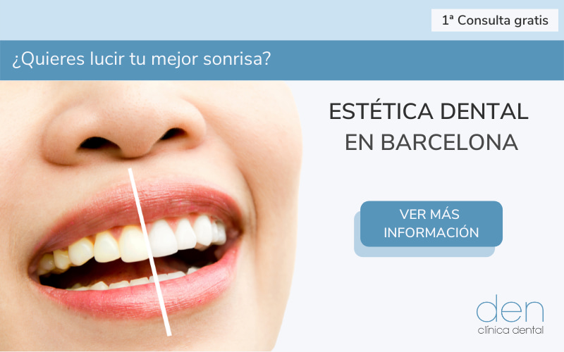 Banner estética dental Barcelona