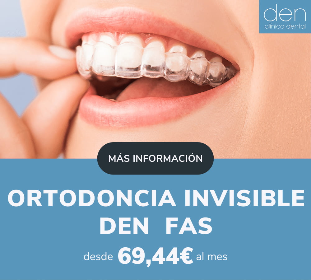 Ortodoncia invisible en Barcelona