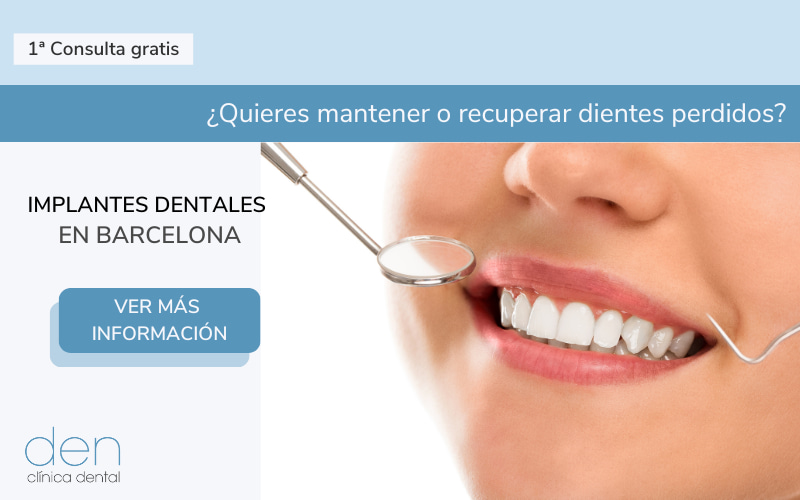implantes dentales Barcelona