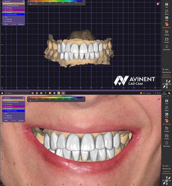 Cad/Cam tecnología