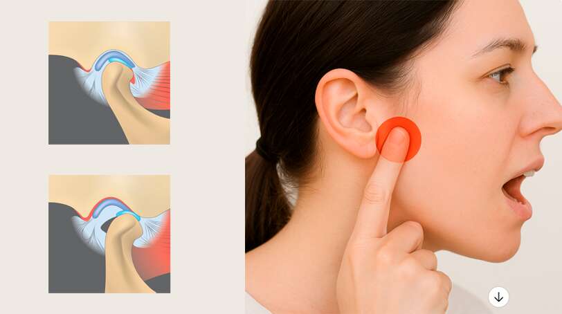 Anatomía de la articulación temporomandibular