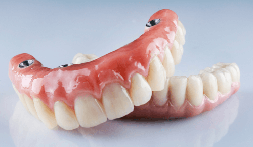 Prótesis Dentales en Barcelona