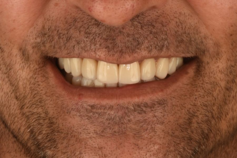 Before image