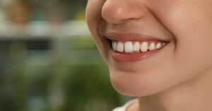 ¿Qué es el diastema, cuáles son sus causas y tratamientos para corregirlo? Diastema dental ¿Cómo se corrige?