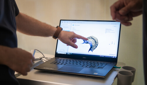 Tecnología digital para prótesis dentales en Barcelona