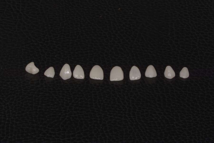 Cómo son las carillas de porcelana dentales