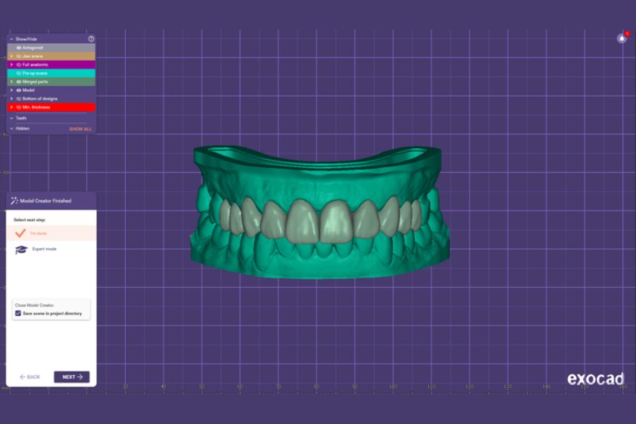 Diseño digital de la sonrisa en carillas dentales