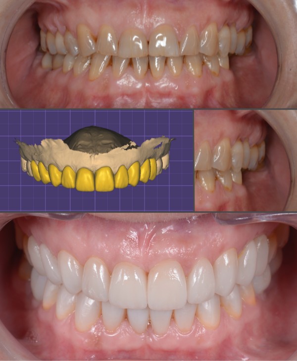 Rehabilitación oral para ATM en Barcelona