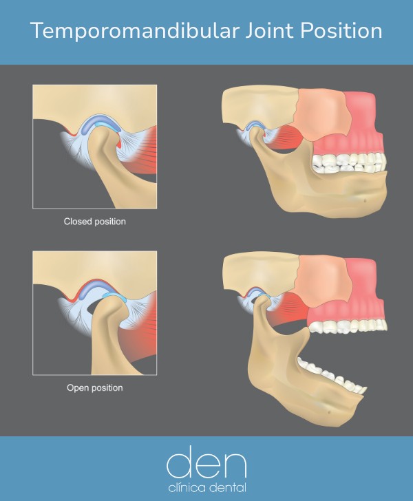 Temporomandibular Joint Position