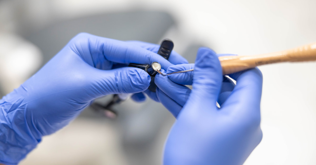 Clínicas Den - ¿Qué es el composite dental, en qué casos se recomienda y cuánto tiempo dura?