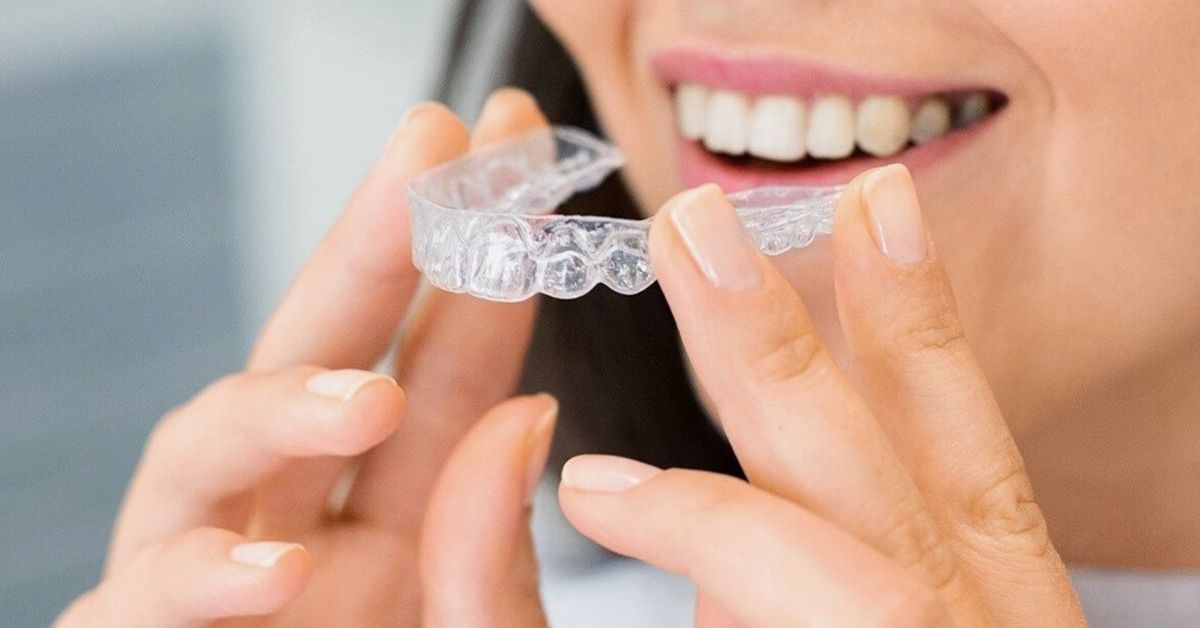 Clínicas Den - ¿Se puede poner ortodoncia con implantes dentales? Clínicas Den - ¿Se puede poner ortodoncia con implantes dentales?