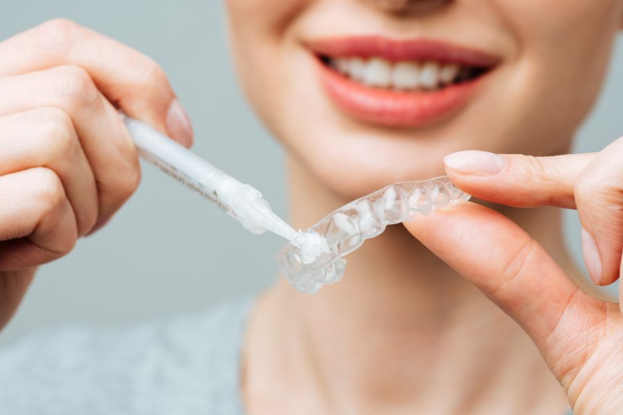 Férulas de blanqueamiento dental