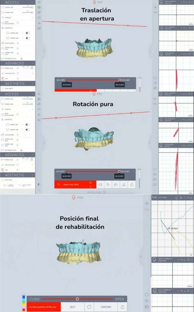 Análisis funcional - Modjaw - 4D
