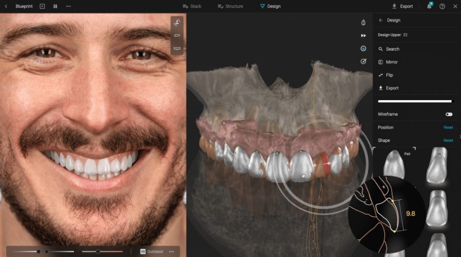 Análisis de sonrisa con Inteligencia Artificial Smilecloud