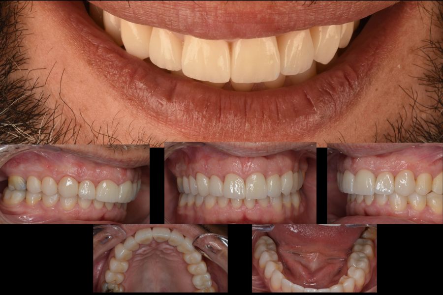 Paciente después del tratamiento