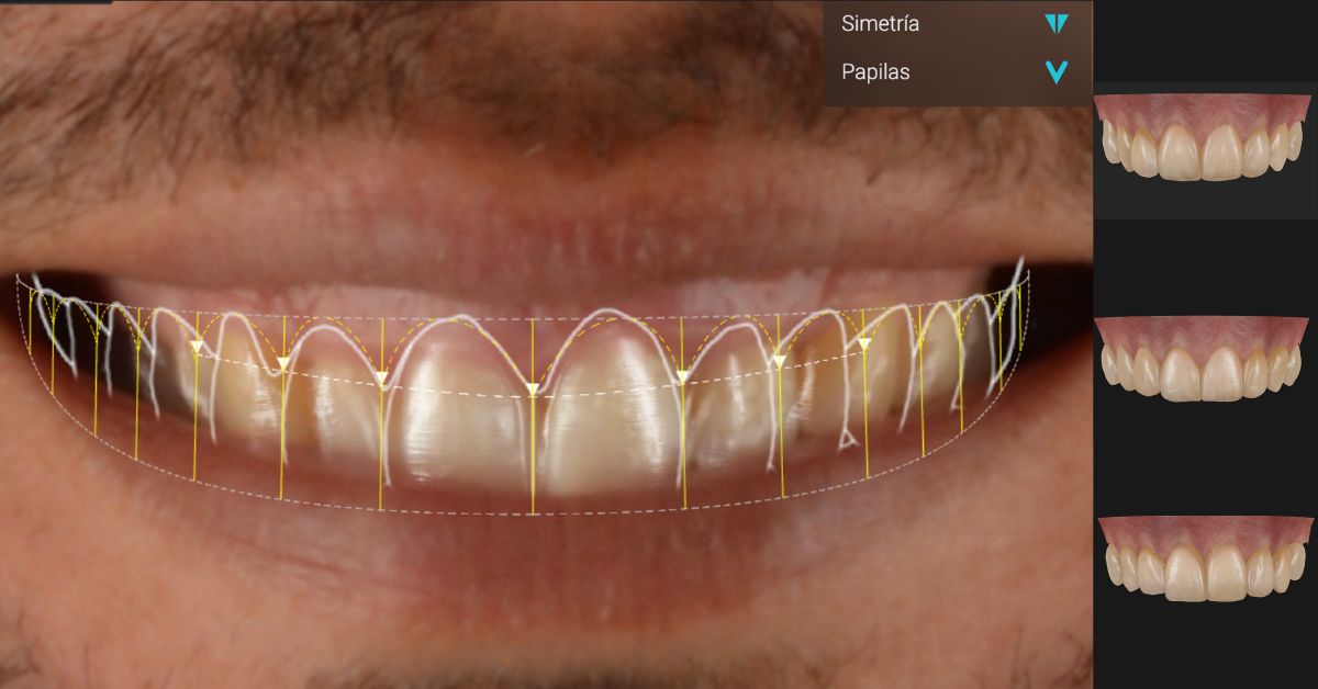 Clínicas Den - ¿Qué es Smilecloud y cómo la tecnología de IA beneficia a los pacientes de nuestra clínica? Clínicas Den - ¿Qué es Smilecloud y cómo la tecnología de IA beneficia a los pacientes de nuestra clínica?