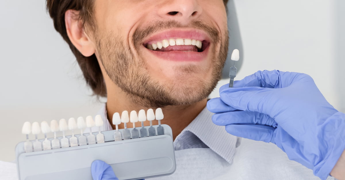 Clínicas Den - Carillas de composite o porcelana ¿Cuál es mejor para ti? Clínicas Den - Carillas de composite o porcelana ¿Cuál es mejor para ti?