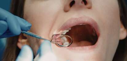 rehabilitacion oral completa