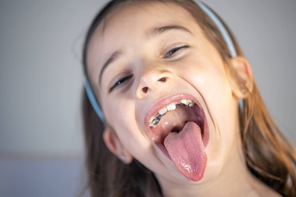 Pediatry Dentistry