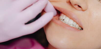 Recidiva dental tras ortodoncia