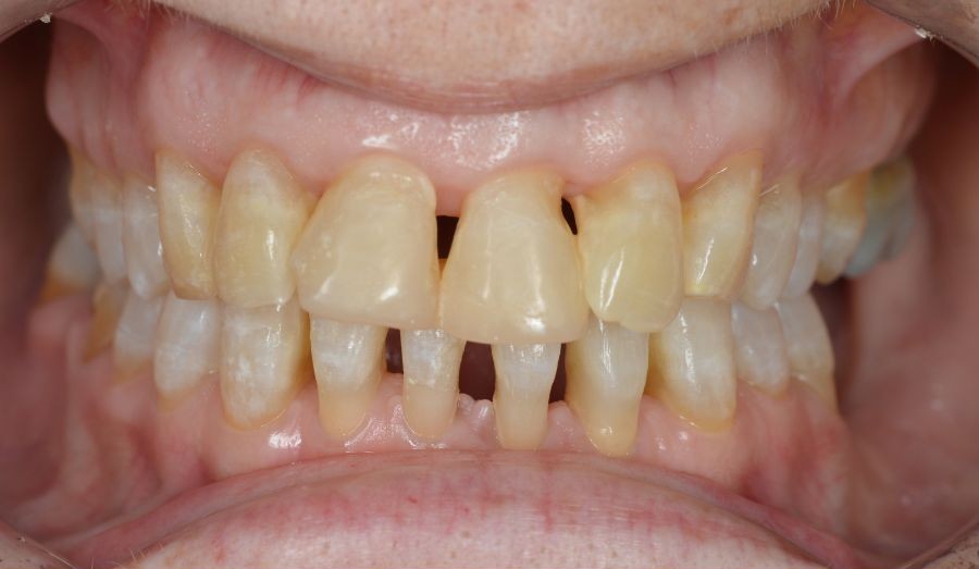 post periodoncia y ortodoncia