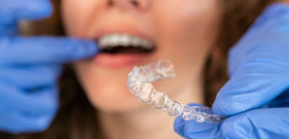 ¿Es posible alinear los dientes sin brackets?